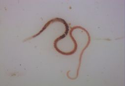 Limnodrilus hoffmeisteri